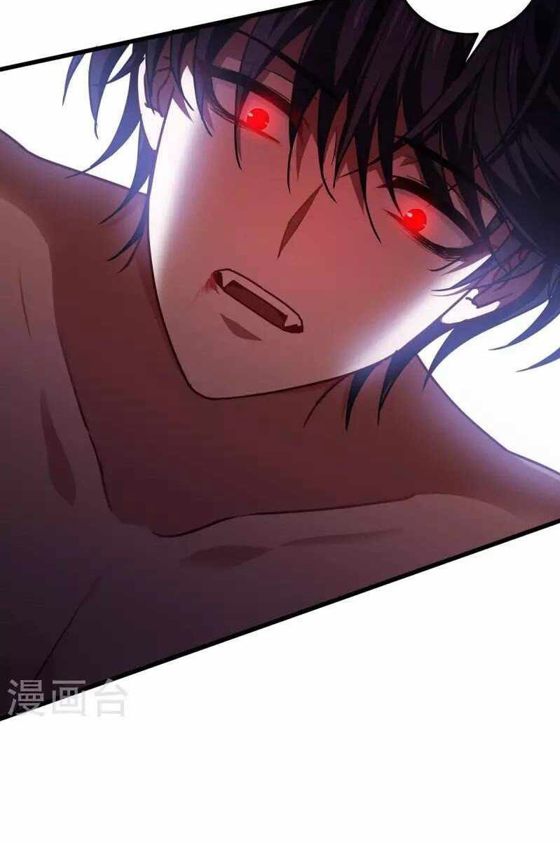 Became King After Being Bitten Chapter 21 Gambar 16