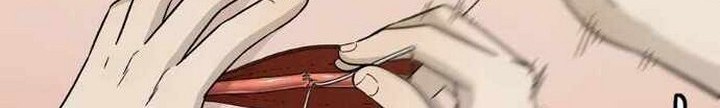 I Reincarnated as a Legendary Surgeon Chapter 18.1 Gambar 13